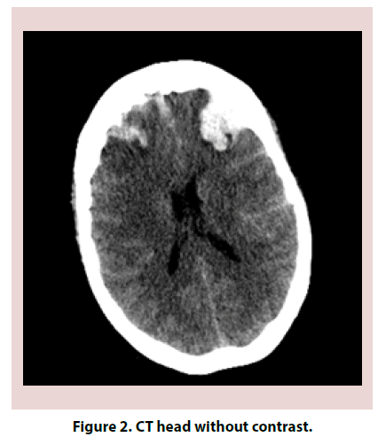 clinical-rheumatology-contrast