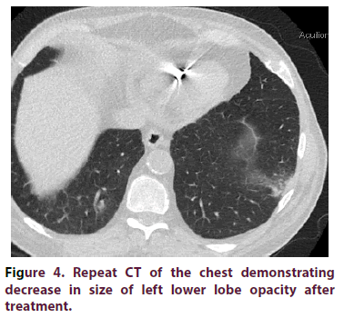 clinical-rheumatology-decrease