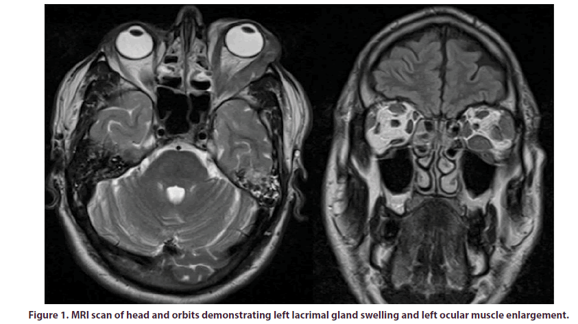 clinical-rheumatology-demonstrating