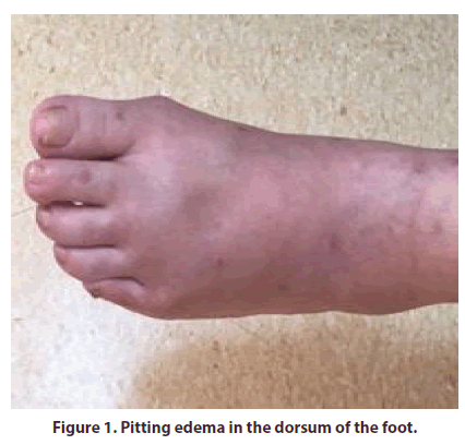 clinical-rheumatology-dorsum