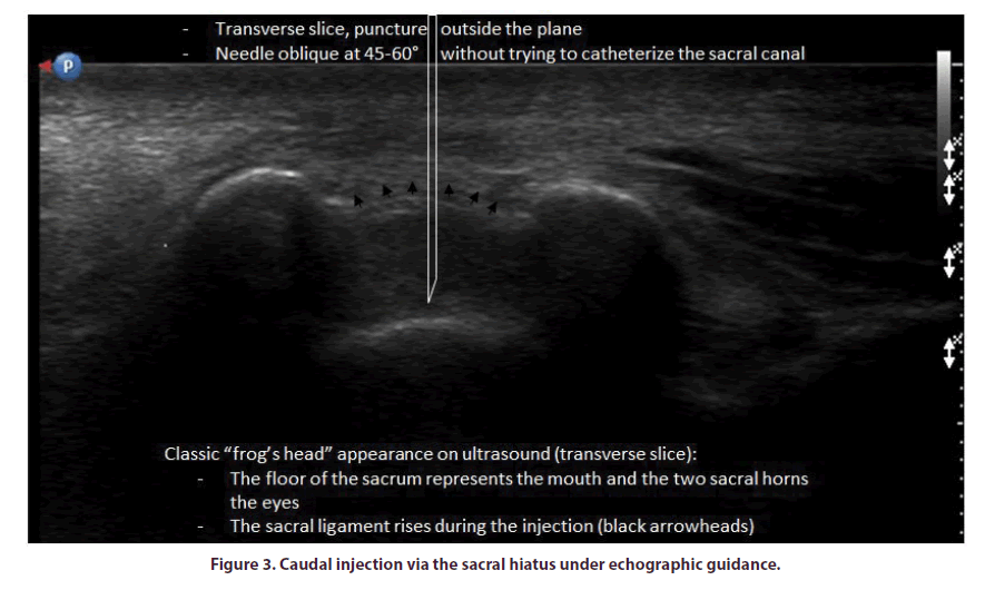 clinical-rheumatology-echographic