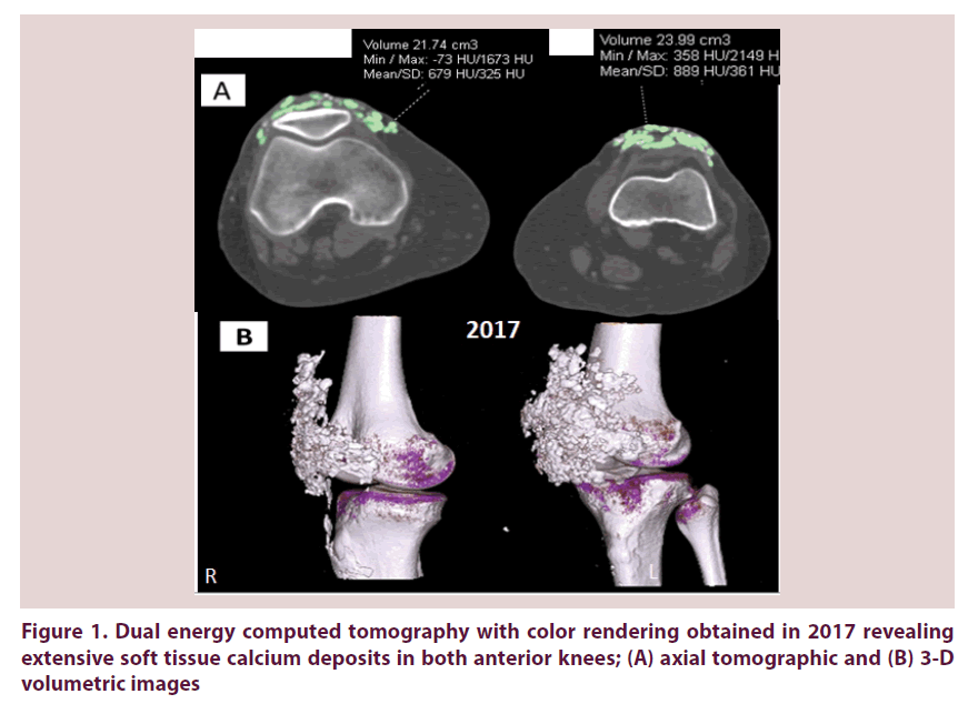 clinical-rheumatology-energy-computed