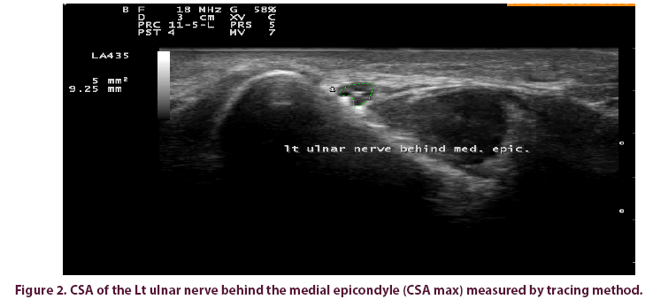 clinical-rheumatology-epicondyle