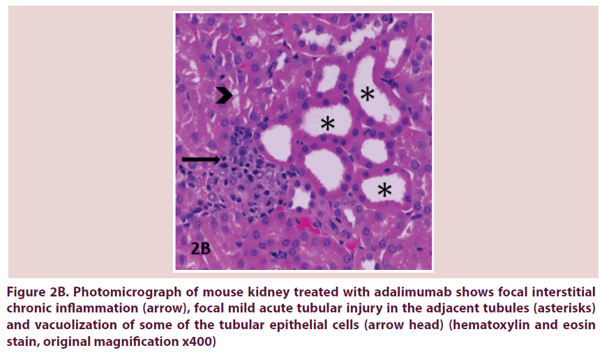 clinical-rheumatology-epithelial-cells