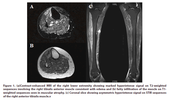 clinical-rheumatology-extremity