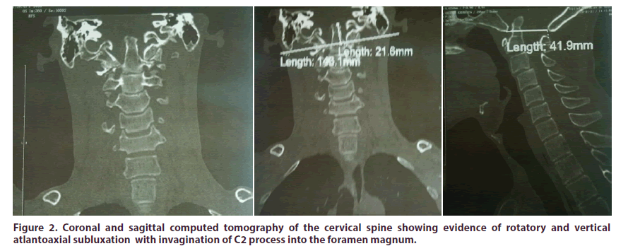 clinical-rheumatology-foramen