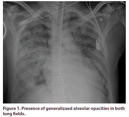 clinical-rheumatology-generalizaed