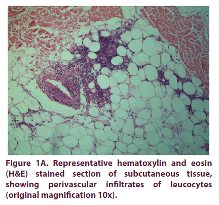 clinical-rheumatology-hematoxylin-eosin