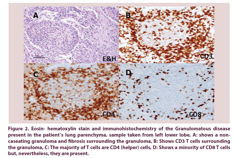 clinical-rheumatology-hematoxylin-stain