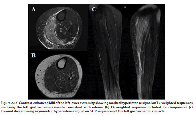 clinical-rheumatology-hyperintense