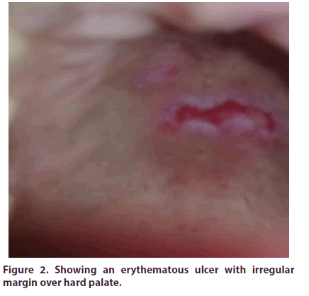 clinical-rheumatology-irregular