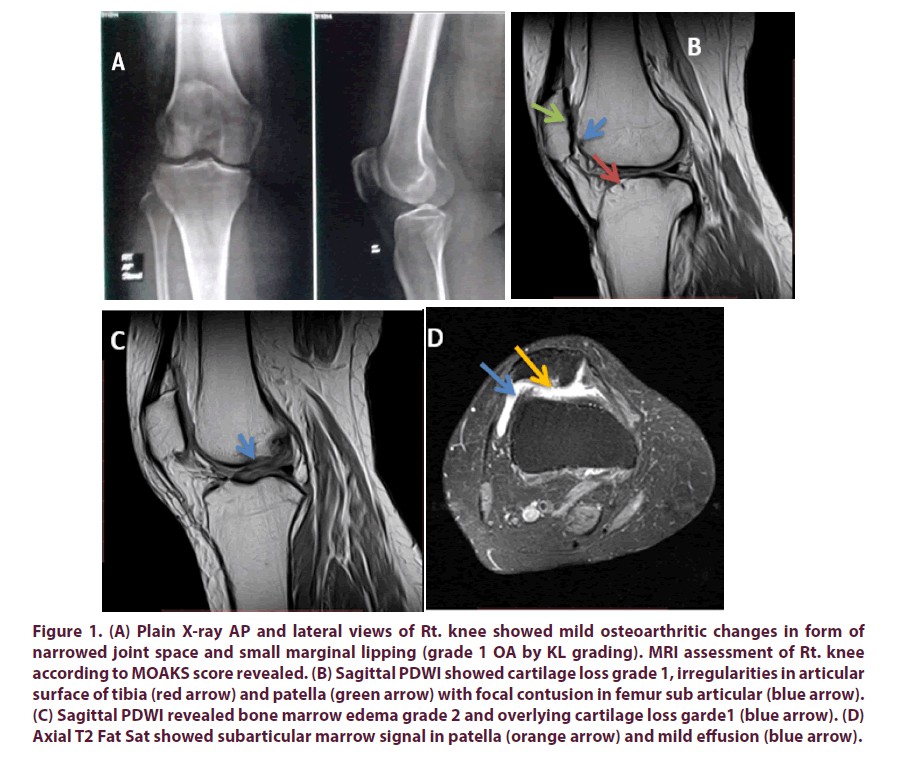 clinical-rheumatology-lateral-narrowed