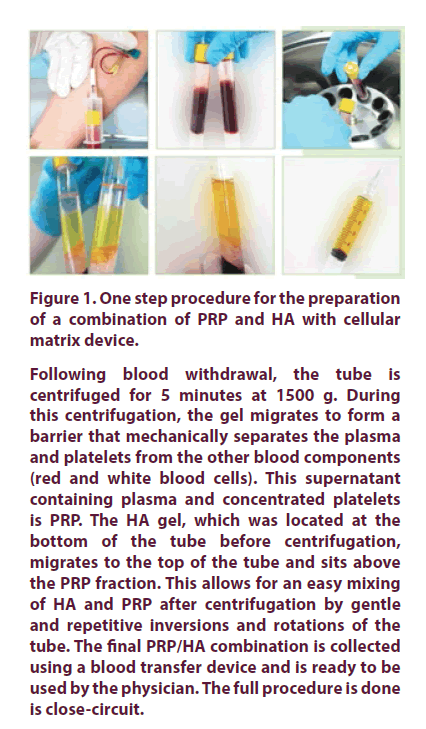 clinical-rheumatology-matrix-device