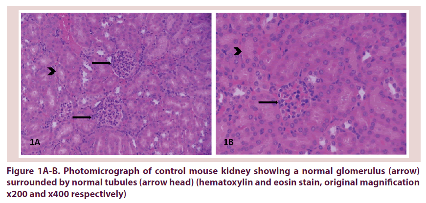 clinical-rheumatology-mouse-kidney