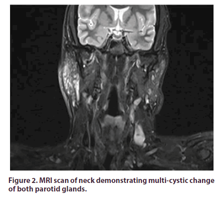 clinical-rheumatology-multi-cystic