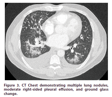 clinical-rheumatology-nodules