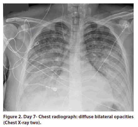 clinical-rheumatology-opacities