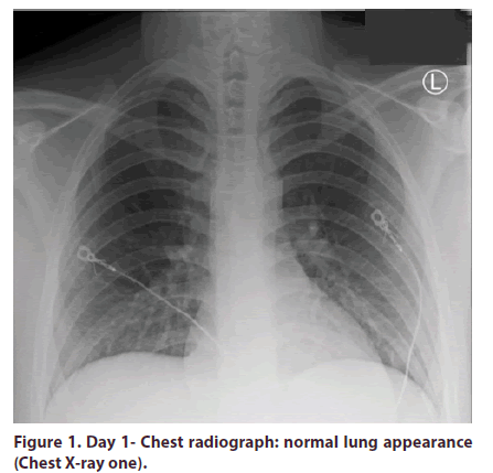 clinical-rheumatology-radiograph