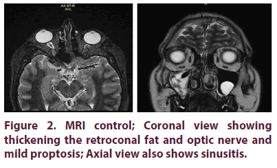 clinical-rheumatology-retroconal-fat