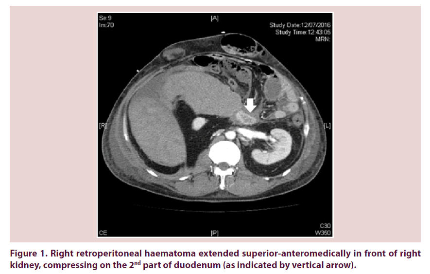 clinical-rheumatology-retroperitoneal-haematoma