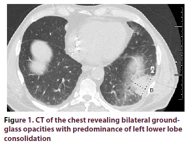 clinical-rheumatology-revealing