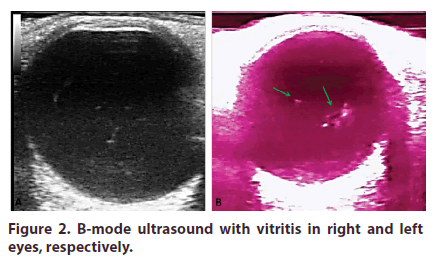 clinical-rheumatology-right