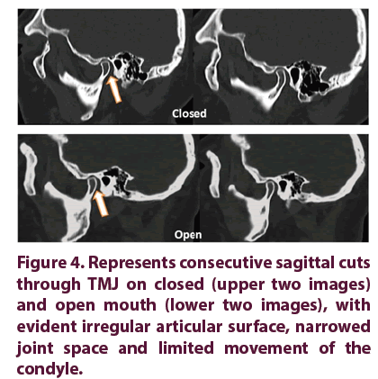 -rheumatology-sagittal-cuts