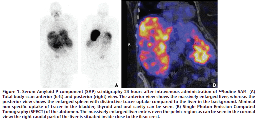 clinical-rheumatology-scintigraphy