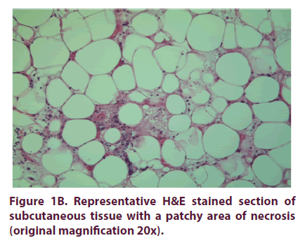 clinical-rheumatology-stained-tissue