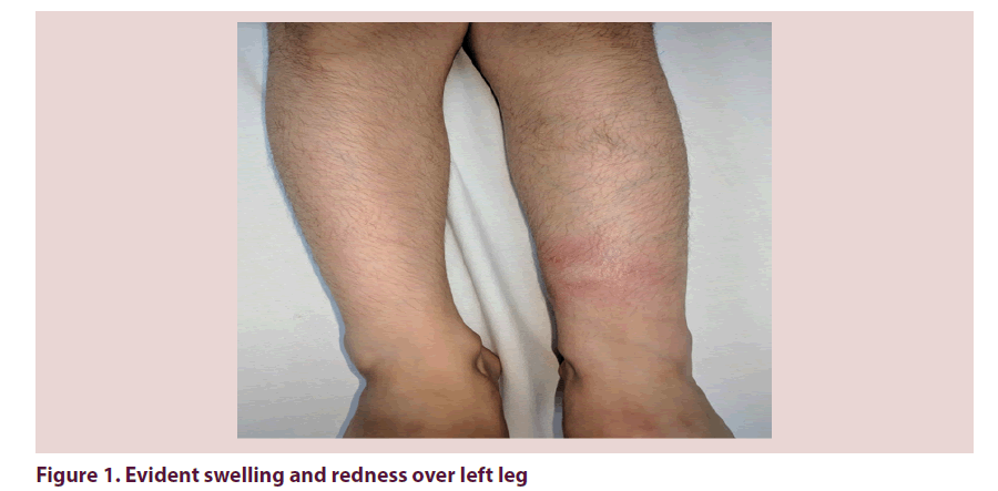 clinical-rheumatology-swelling-redness