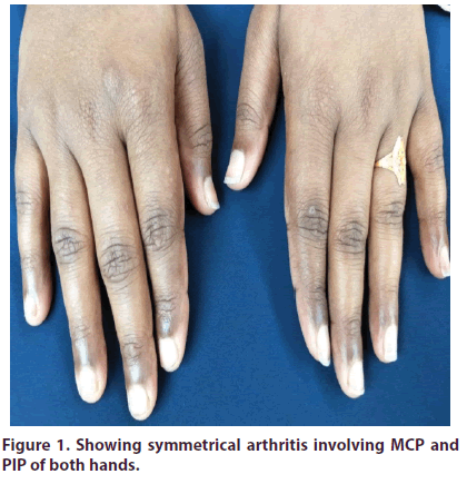 clinical-rheumatology-symmetrical