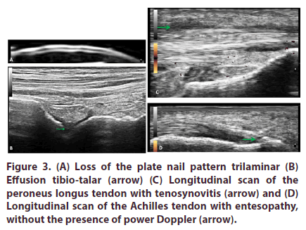 clinical-rheumatology-tendon