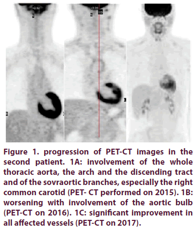 clinical-rheumatology-thoracic-aorta