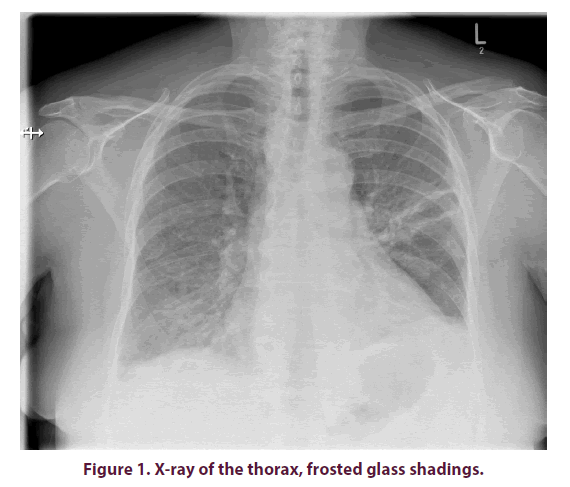 clinical-rheumatology-thorax-frosted