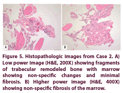 clinical-rheumatology-trabecular-remodeled