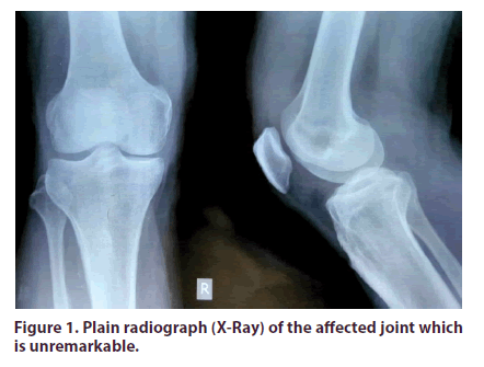 clinical-rheumatology-unremarkable