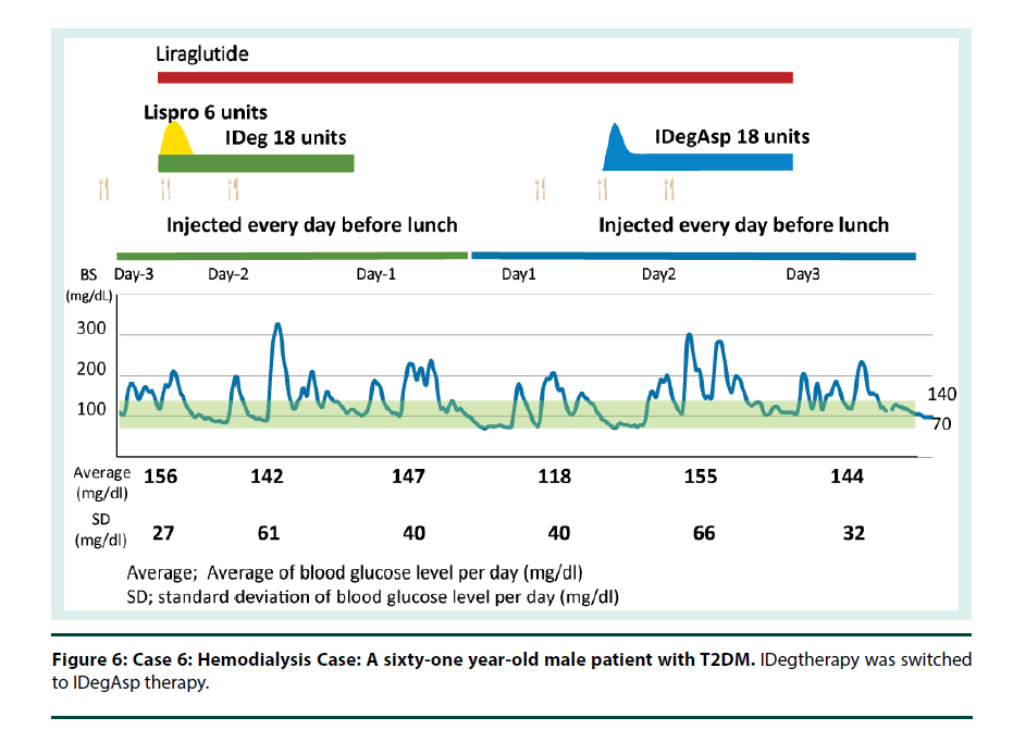 diabetes-management-Hemodialysis-Case