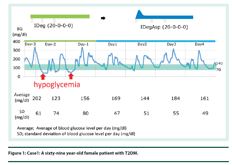 diabetes-management-female-patient