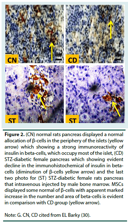diabetes-management-immunoreactivity