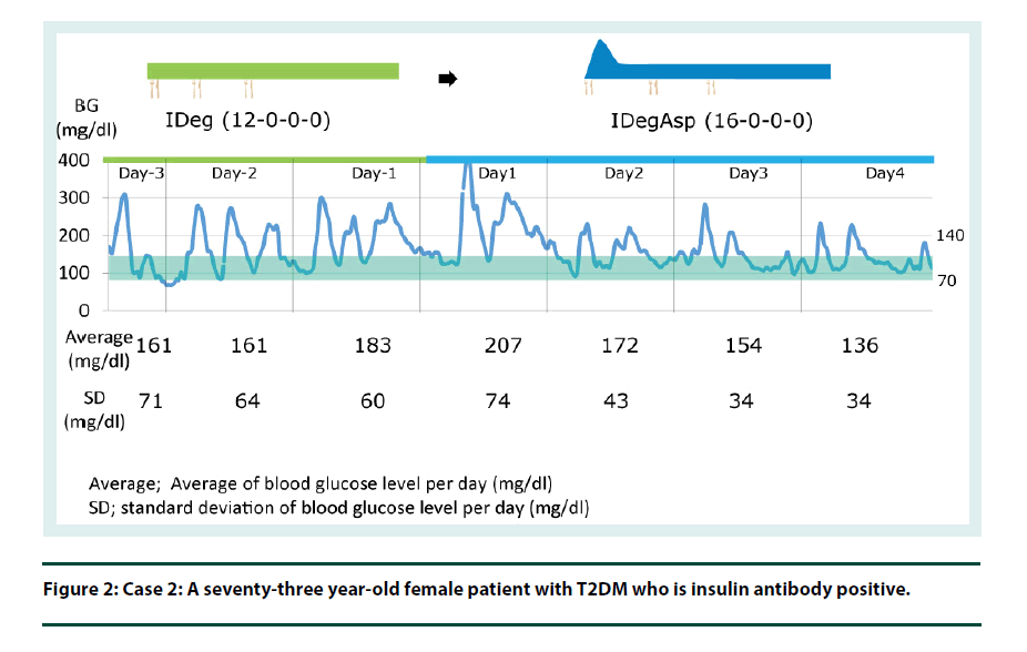 diabetes-management-insulin-antibody