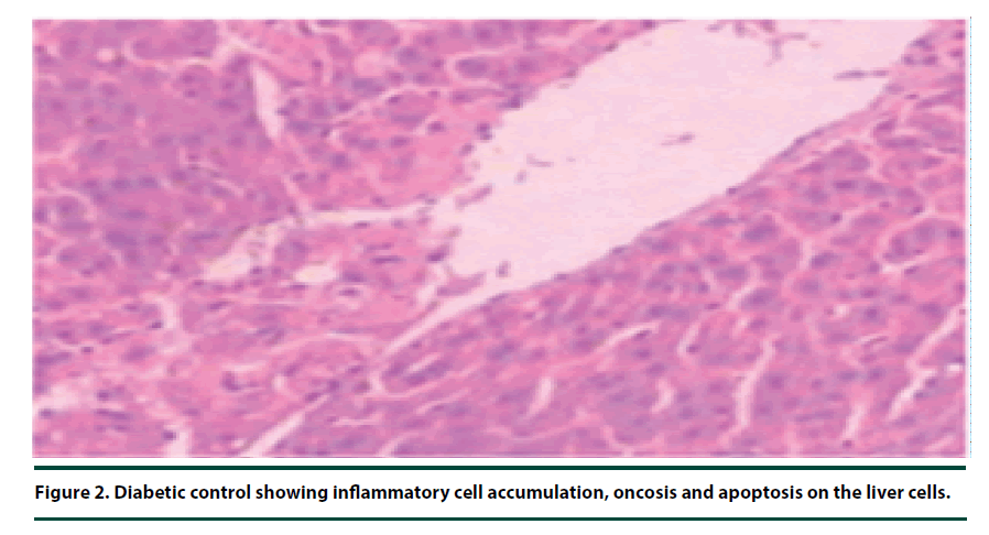 diabetes-management-liver-cells