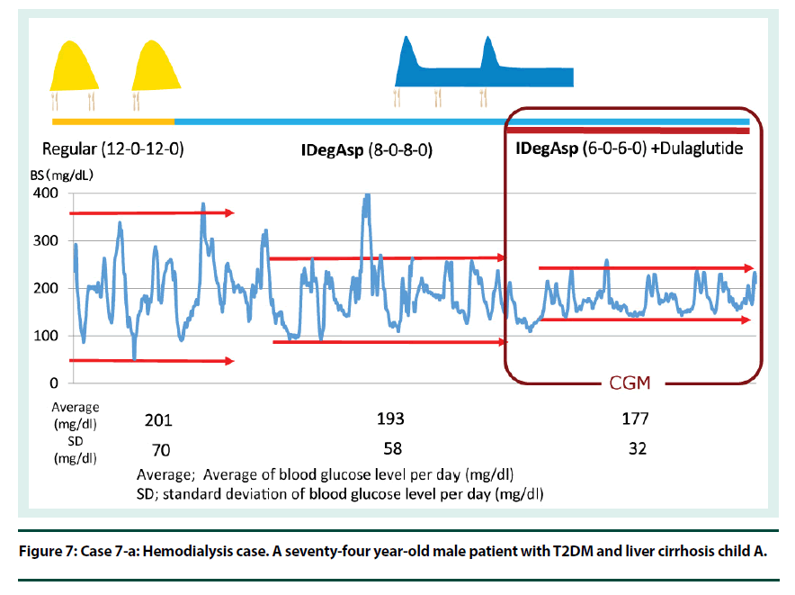 diabetes-management-liver-cirrhosis