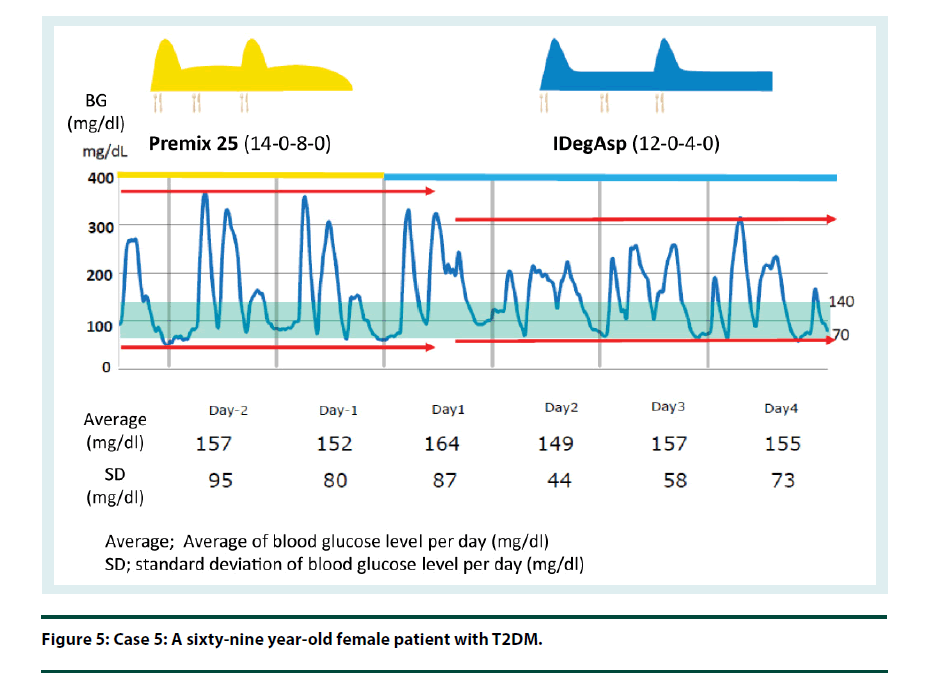 diabetes-management-sixty-nine