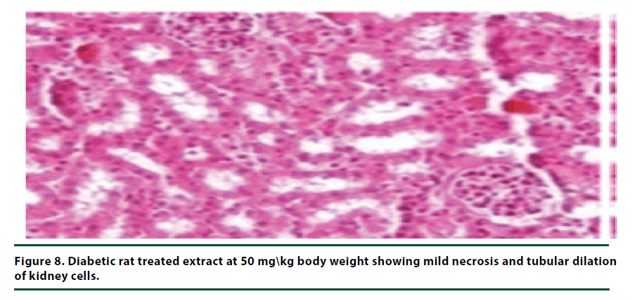 diabetes-management-tubular-dilation