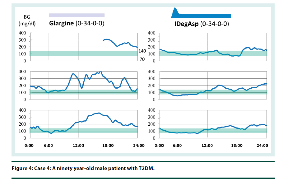 diabetes-management-year-old