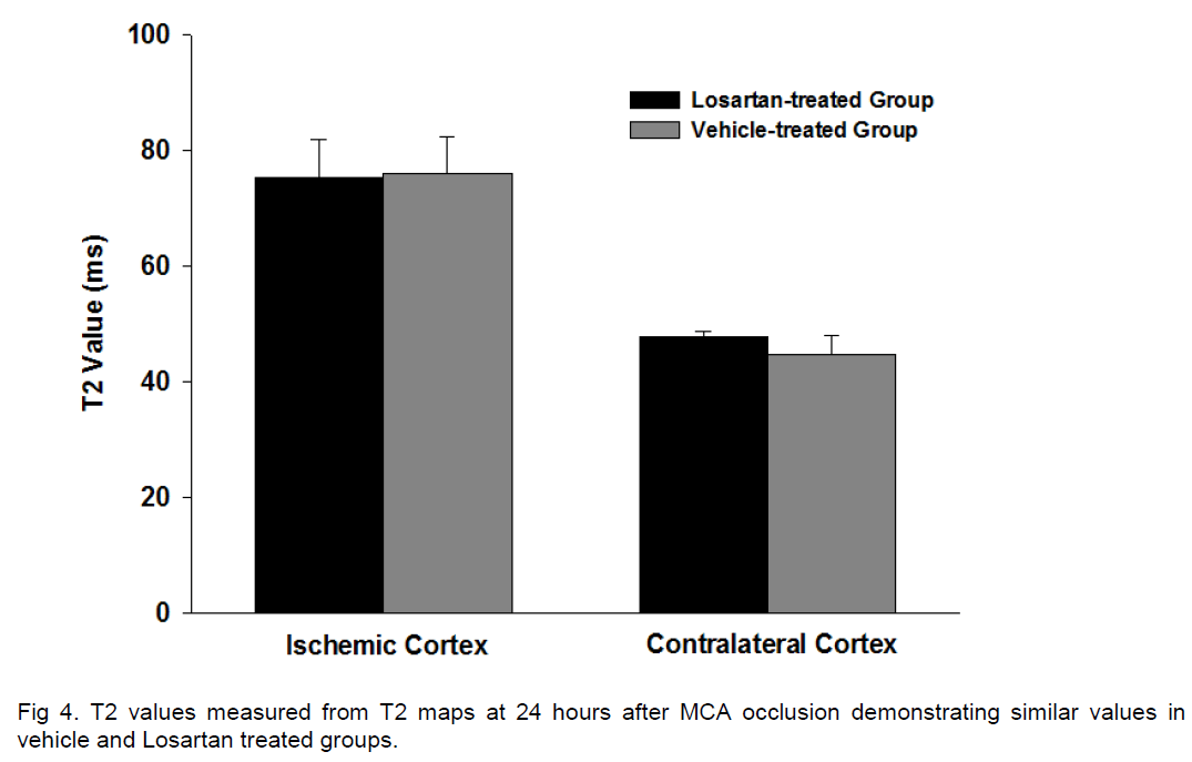 experimental-stroke-MCA-occlusion