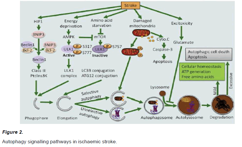 experimental-stroke-ischaemic-stroke