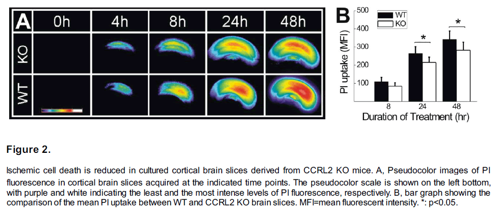 experimental-stroke-translational-medicine-Ischemic-cell