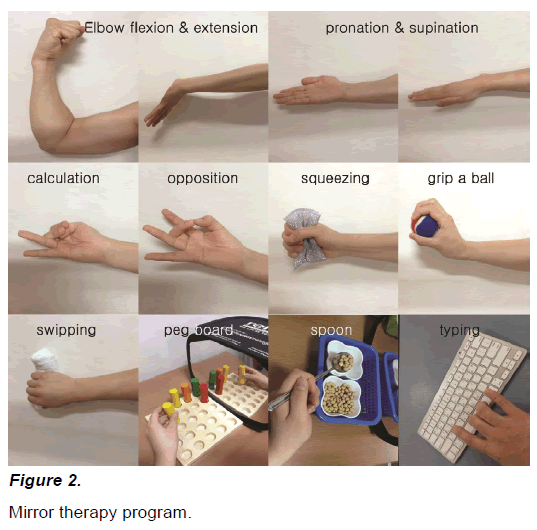 experimental-stroke-translational-medicine-Mirror-therapy