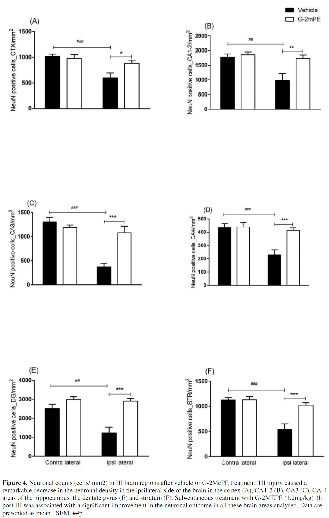 experimental-stroke-translational-medicine-Neuronal-counts